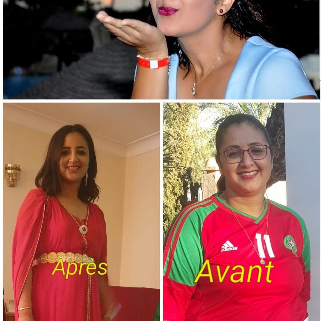 Morphologie - Avant et Après